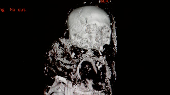 Mummy Scan2.jpg
